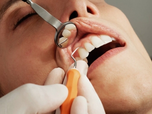 Are there any risks of teeth bonding?