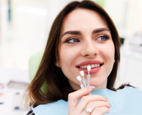 Dental Veneers: Everything You Need To Know