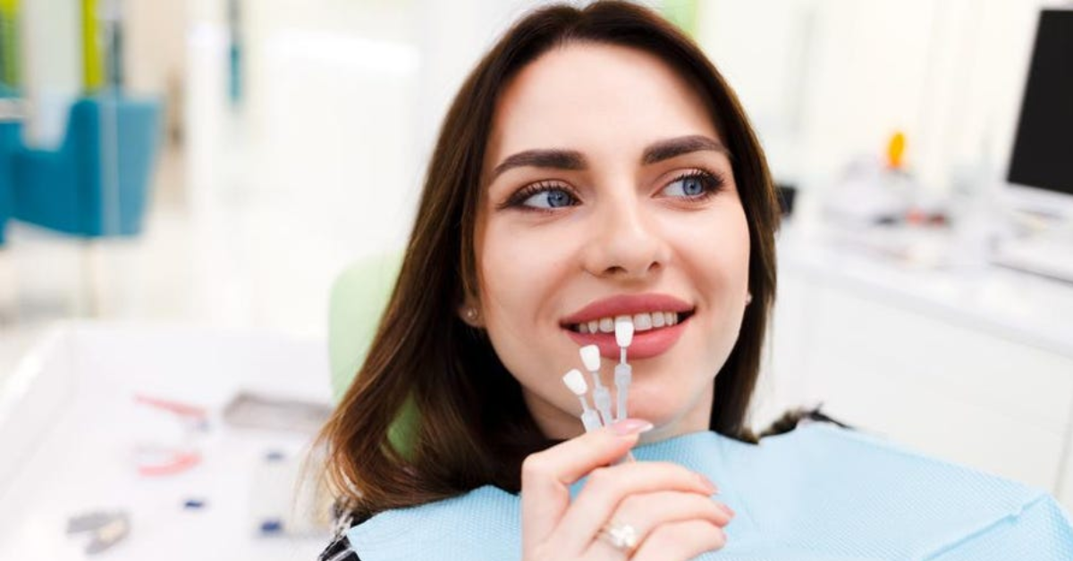 Dental Veneers: Everything You Need To Know