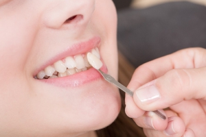 Dental crown procedure