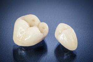 Your dental crown lasts for a long time.