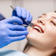 Teeth Bonding: What You Need to Know